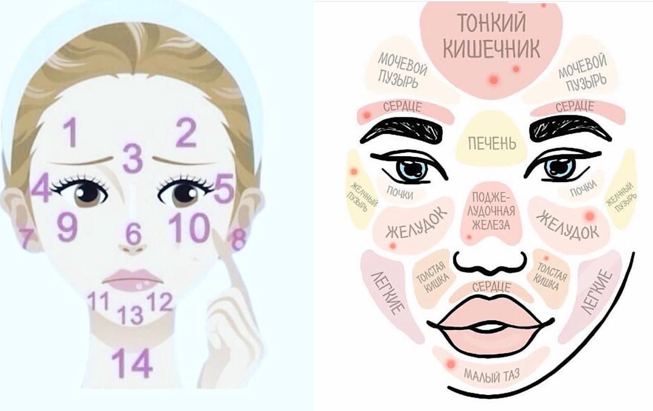 Acne face map true or a myth